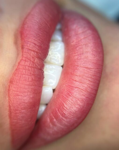 Lip blush processen 💋➡️ 

Nylavede - læberne kan være ømme og hævede 

Dagen efter - læberne føles tørre (og skal holdes tørre i 48 timer) 

2 dage efter - læberne kan begynde at skalle af (den mest trælse periode) 

2.5 uge efter - du føler læberne har mistet alt deres farve, men giv det noget tid så ser du pigmentet stille komme til syne 

Obs - billederne her er kun efter 1. behandling, og efter 5-8 uger efter 1. behandling, skal der igen laves læbepigmentering for derefter at kunne gå 1-2 år før næste retouch ❤️💋