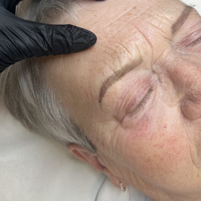 Efter første behandling ➡️ efter anden behandling 

Derefter går der et års tid før jeg ser søde Rie igen ❤️